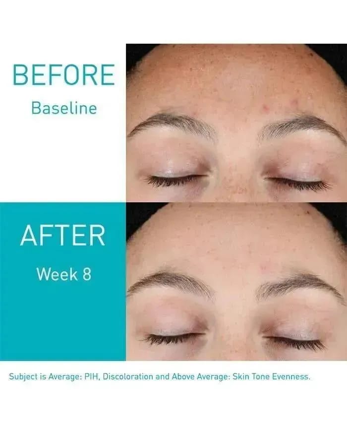 CeraVe Skin Renewing Retinol Serum ā Visible Before & After Results | Smooth, Bright & Youthful Skin